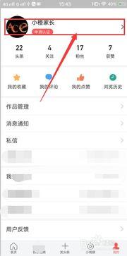 怎样设置头条个人的名字,如何巧妙设置头条个人名字，打造独特个人品牌