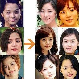 女明星整容失败照片